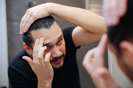 Middle aged caucasian white man with a short beard looks at his hair in the mirror in the bathroom and worried about balding. The concept of the problem of male hair loss, early baldness and alopecia