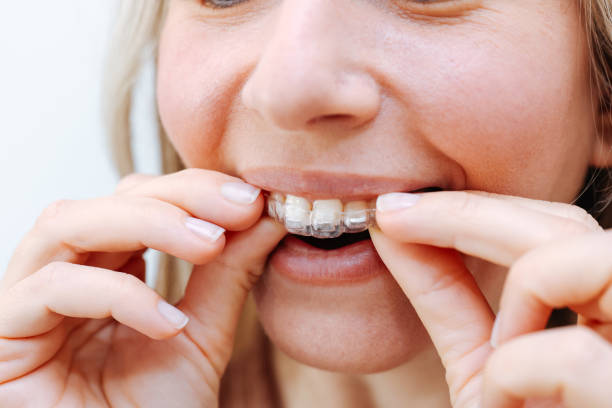 istock Woman Taking off Her Clear Retainer in the Bathroom Mirror 2138920379