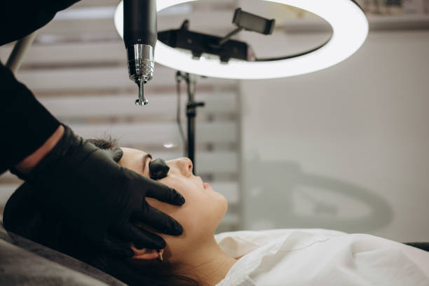 Laser removal of permanent makeup. The beautician removes the tattoo from the eyebrows Laser removal of permanent makeup. The beautician removes the tattoo from the eyebrows. permanent makeup before and after stock pictures, royalty-free photos & images
