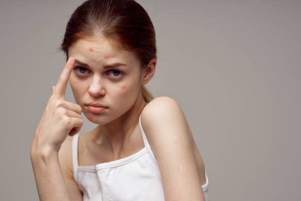 istock beautiful woman gesturing with her hands near face acne skin problems acne 2141070872