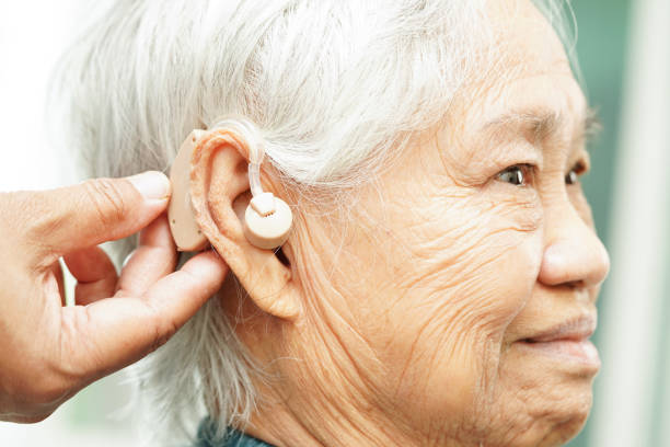 istock Doctor install hearing aid on senior patient ear to reduce hearing loss problem. 2142793730