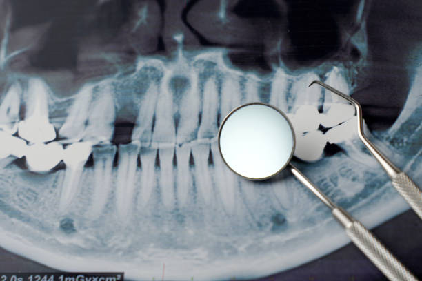 istock Dental x-ray and dentist tool, close-up. Dental background 2145850938