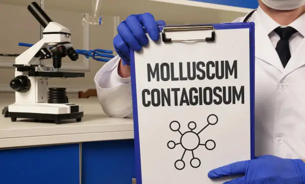 Molluscum contagiosum is shown using a text