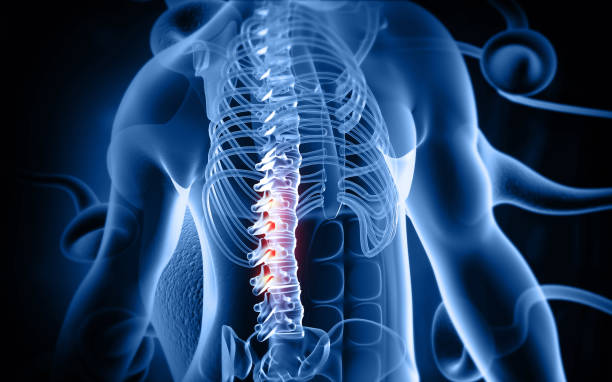 istock Human back pain spine disc bulge 2147510815