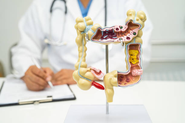istock Intestine, appendix and digestive system, doctor holding anatomy model for study diagnosis and treatment in hospital. 2147573002