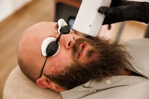 High angle view of young man having laser epilation of cheekbones in beauty salon