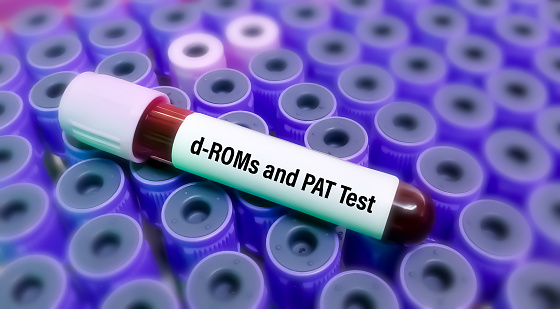 d-ROMs (derivatives-reactive oxygen metabolites) PAT (plasma antioxidant capacity) tests are oxidative indexes. Severe asthma has been related to oxidative stress.