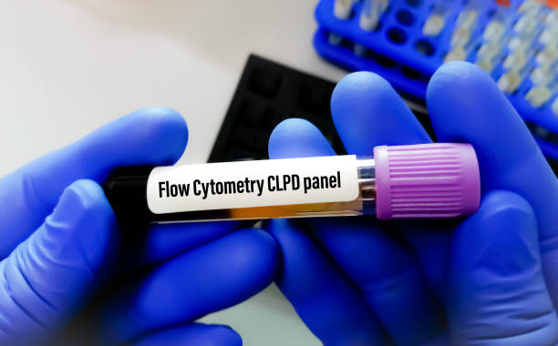 istock Flow Cytometry CLPD panel test, to diagnose chronic lymphoproliferative disorders. 2147672025