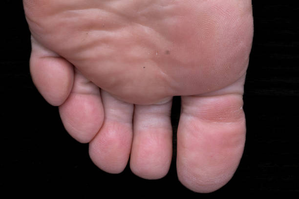 part of a foot from woman or man