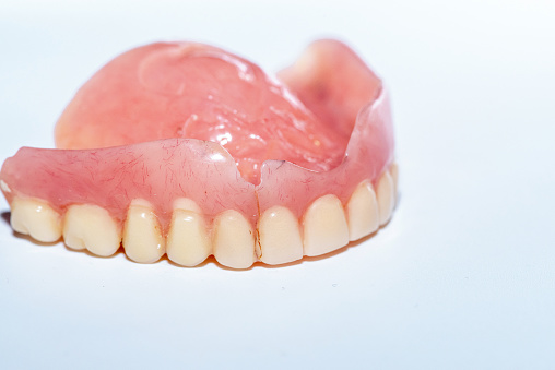 Old denture on a white background.