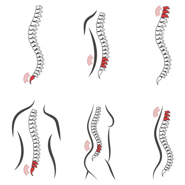 Vector illustration of Back pain vector illustration