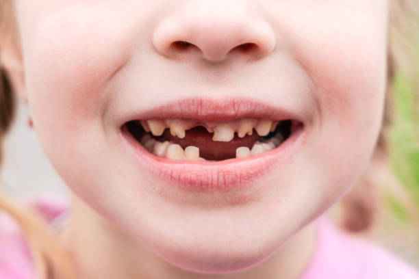 istock Kid shows off first missing tooth. Children without one tooth smiles 2148233159