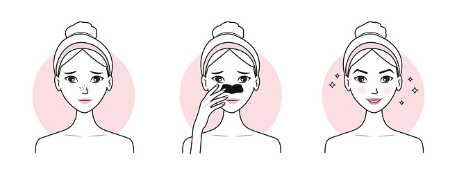 Cute woman with step of blackheads treatment on nose vector illustration isolated on white background. Before and after nose pore strip remove blackheads on face. Skin care and beauty concept.