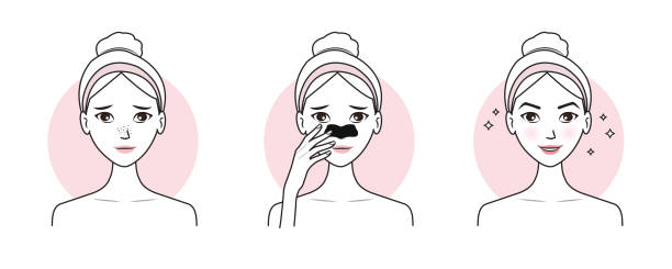 202404-Blackheads treatment Cute woman with step of blackheads treatment on nose vector illustration isolated on white background. Before and after nose pore strip remove blackheads on face. Skin care and beauty concept. black face mask side view stock illustrations