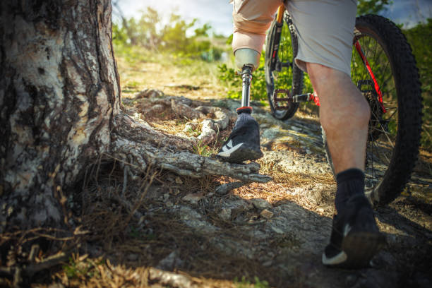 man with a prosthetic leg ride a mountain bike on a hill