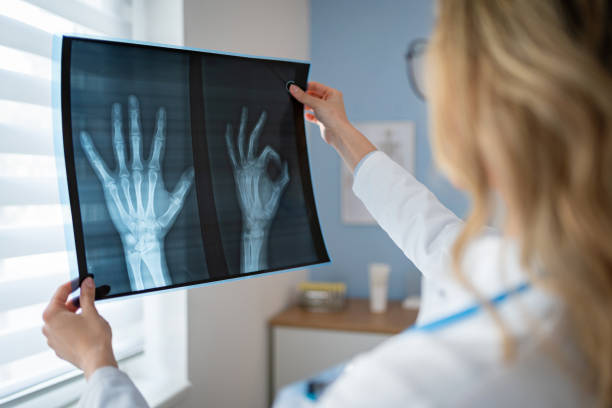 istock Caucasian female radiologist, looking at the patient x-ray image 2148380464