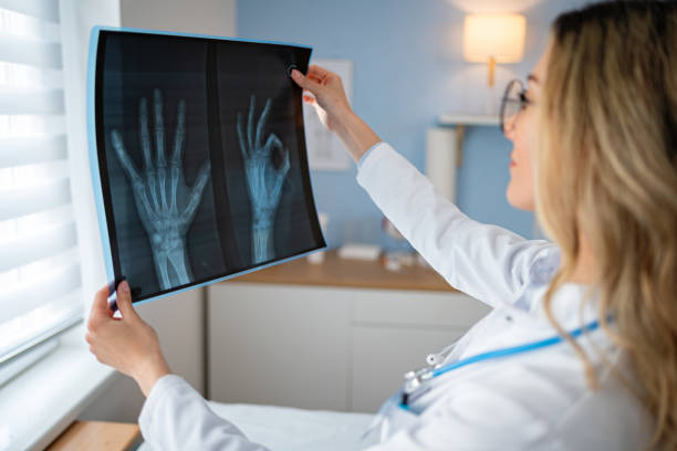istock Caucasian female radiologist, looking at the patient x-ray image 2148380465