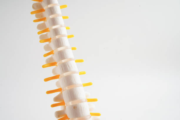 istock Spinal nerve and bone, Lumbar spine displaced herniated disc fragment, Model for treatment medical in the orthopedic department. 2148385443