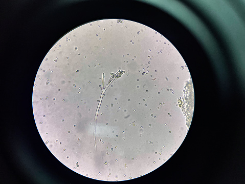 Budding yeast cell in nature smear in environment.
