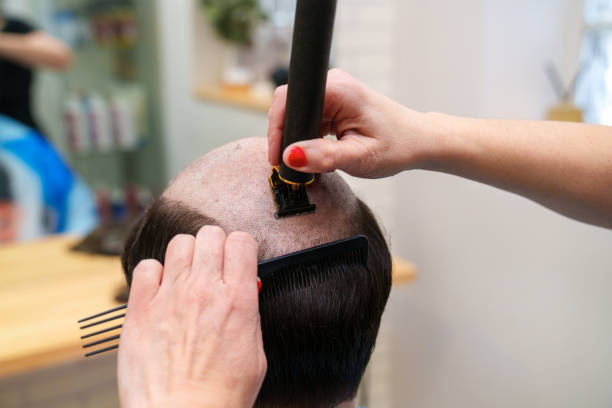 istock Precise Hair Trimming for Prosthesis Integration at Hair Clinic 2148624513