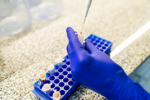 Close-up view of a scientist's hands pipetting a sample into test tubes during a scientific research experiment in a laboratory.