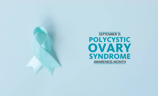 istock Polycystic Ovary Syndrome 2148746276
