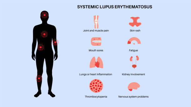 420+ Systemic Disease Stock Illustrations, Royalty-Free Vector