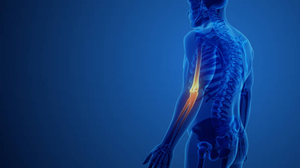 Explore the anatomy of elbow pain in this detailed 3D medical image. Delve into the complexities of the human joint, examining conditions like arthritis, inflammation, and fractures. Ideal for healthcare professionals and educational purposes.
