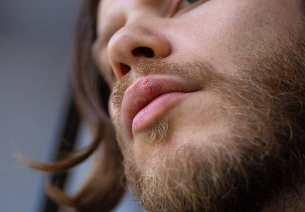 Close-up of a man's unshaven jawline and lips