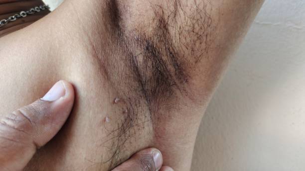 istock Armpit hair and wrinkle. 2148893406