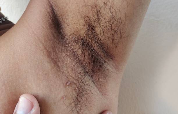 istock Armpit hair and wrinkle. 2148893422