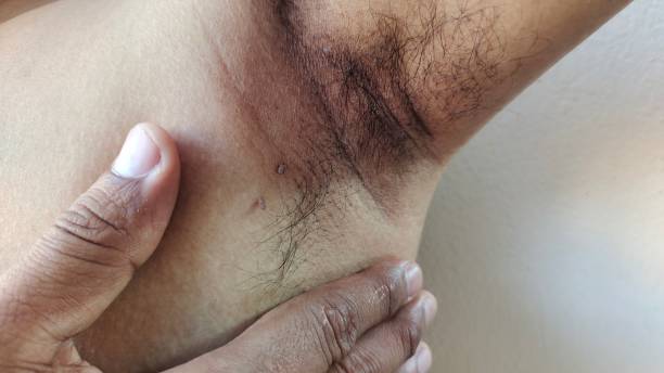 istock Armpit hair and wrinkle. 2148893431