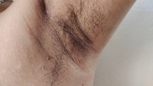 istock Armpit hair and wrinkle. 2148893442