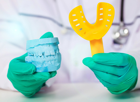 Doctor dentist holds a yellow spoon and an impression of the patient's jaw in green medical gloves. The concept of making dentures and dental crowns based on a patient s impression in a dental laboratory.
