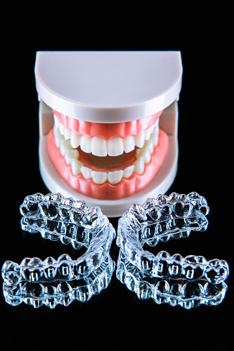 Close-up. Transparent aligners for artificial jaw teeth lie on a mirror on a black background