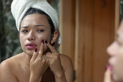 Young woman engages in evening skincare routine, addressing facial pimples in a mirror