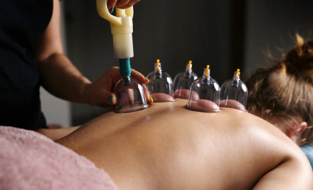 istock Massage Therapist Doing Back Vacuum Massage With Cups In Spa 2148971556