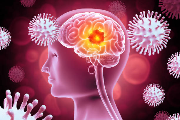 istock Brain tumor or barin cancer. 3d illustration 2148990223