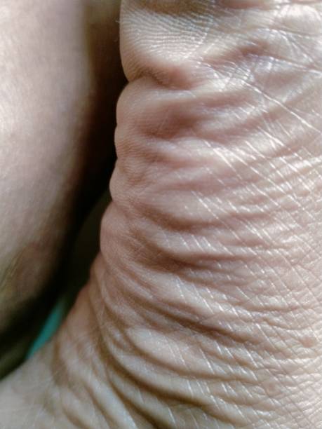 A old man foot leg skin