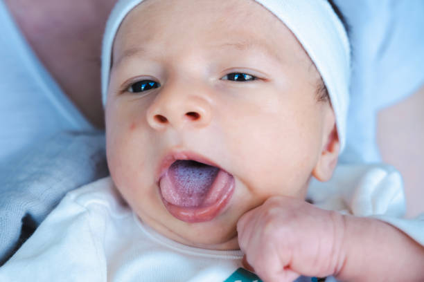 0-1 Months, Babies Only, Baby - Human Age, Baby Boys, Care el recién nacido tiene candidiasis en la lengua. enfermedades del bebé. cuidado del bebé. la candidiasis, una infección fúngica que se produce en la boca o en la superficie de la lengua, es una enfermedad causada por un hongo llamado candida albicans.
