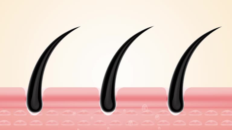 Alopecia, Hair Loss or Scalp Losing Hair from Root Process Animation Concept. Hair Follicle and Shaft Failing. Haircare Anatomy