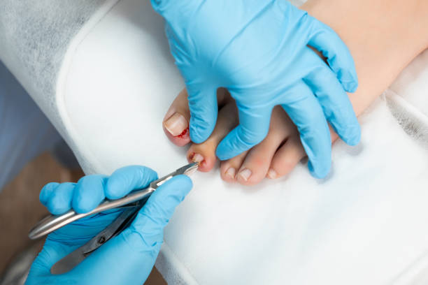 istock Professional medical pedicure using special nail instruments in the clinic 2149388171