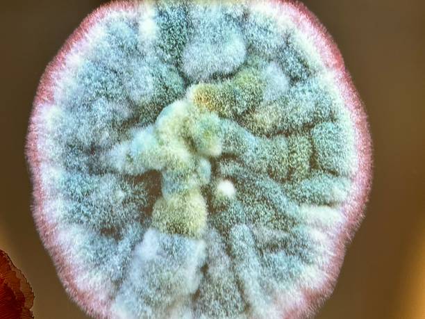 istock Microscopic image of fungus growth 2149573602