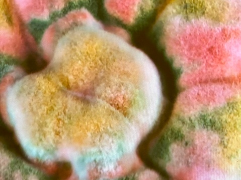Microscopic image of fungus growth