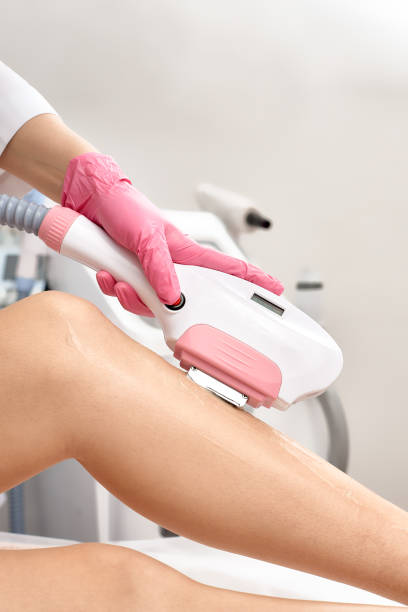 istock Laser depilation or photoepilator process on a woman leg. 2149640977