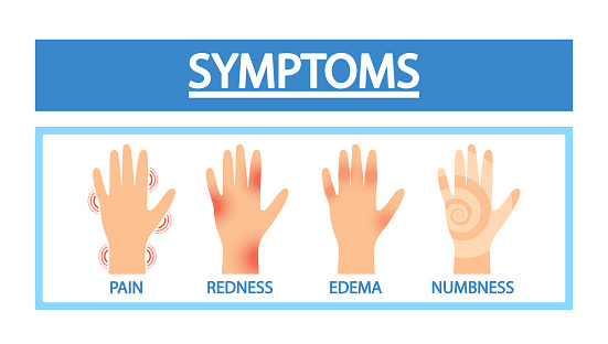 Arthritis Symptoms. Sick Hands With Joint Pain, Redness, Edema Or Numbness. Medical Infographic Poster for Seek Medical Advice For Diagnosis And Management. Information for Health Care