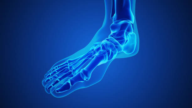 istock Painful gout inflammation on big toe joint 2149770082