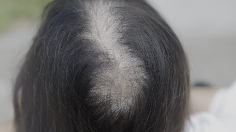 Senior aged asian woman concern about gray hair in menopause..
