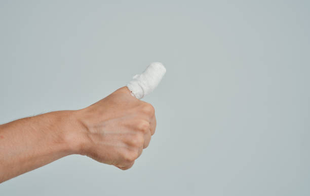 istock man with broken thumb health problems medicine patient 2149859280