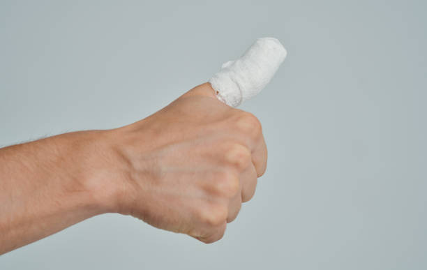 istock man with broken thumb health problems medicine patient 2149859549